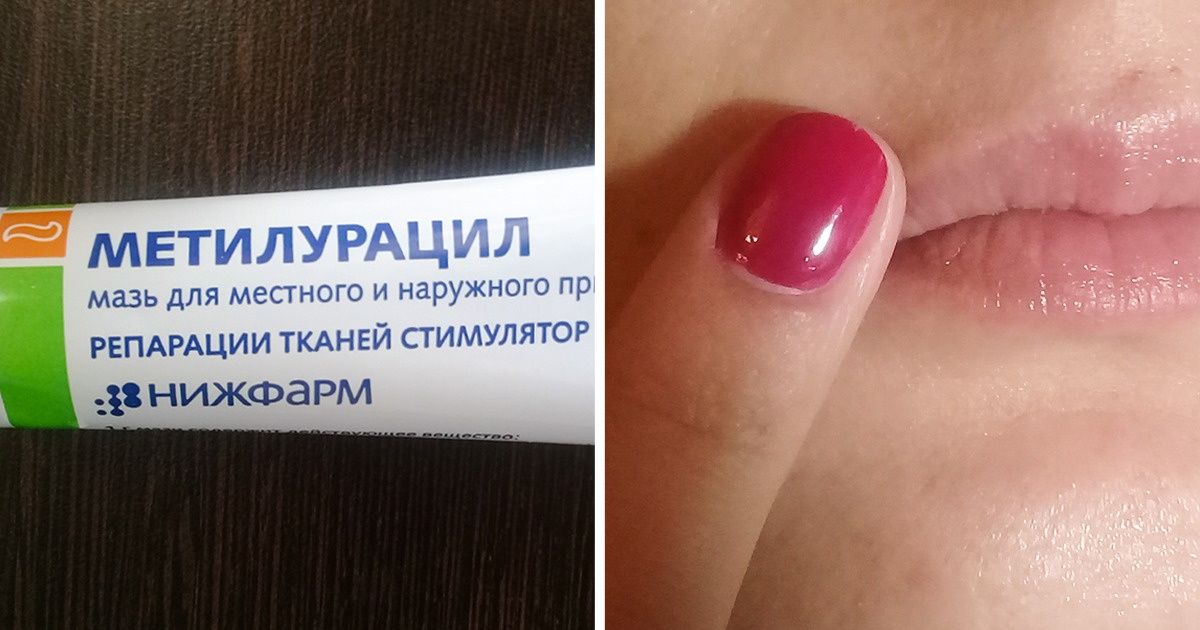 12 аптечных средств против старения кожи, которые действуют не хуже дорогой косметики