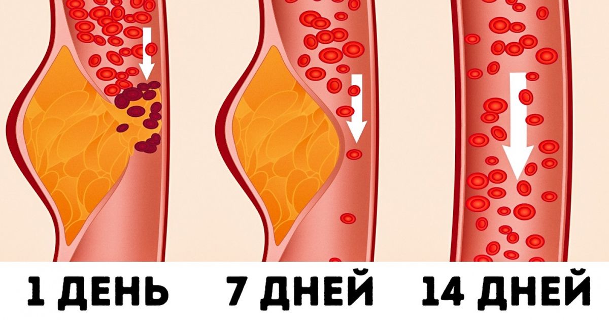 Что такое DASH-диета и почему, по оценкам врачей, она считается лучшей для здоровья