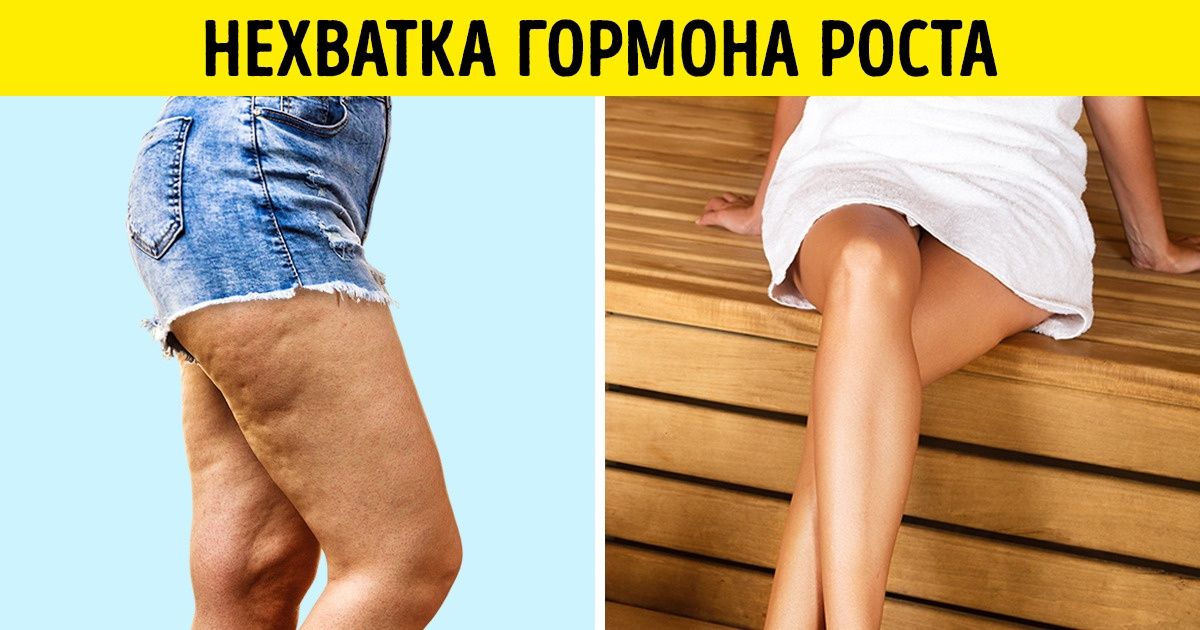 6 гормонов, из-за которых женщины стареют раньше времени
