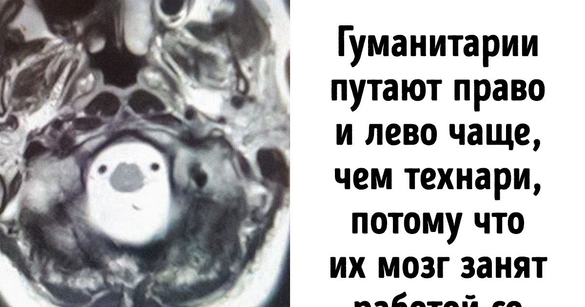 Человек Который Путает Стороны Человек Который Путает Стороны