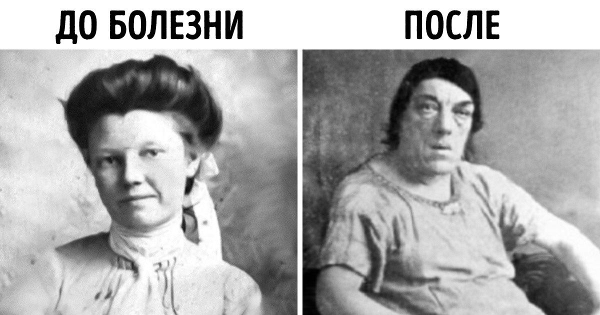 История женщины, которая ради детей не побоялась стать посмешищем